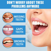 Jaysuing Moldable Dental Filling Cavity Adhesive (30ml box), Film And Television Makeup Denture Modification Adhesive, False Dental Filling, Broken Tooth Temporary Dental Filling Adhesive